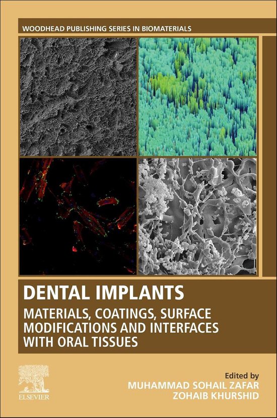 Woodhead Publishing Series in Biomaterials - Dental Implants - cover