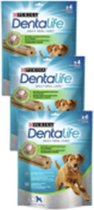 3x Purina Dentalife Daily Oral Care Large - Hondensnacks - 142g