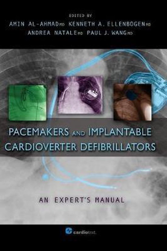 Foto: Pacemakers and implantable cardioverter defibrillators