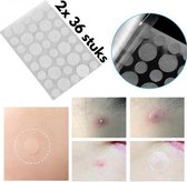 72 Stuks Acne Patches | Stickers voor het Verwijderen van Acne / Puisten - 2x 36 Stuks