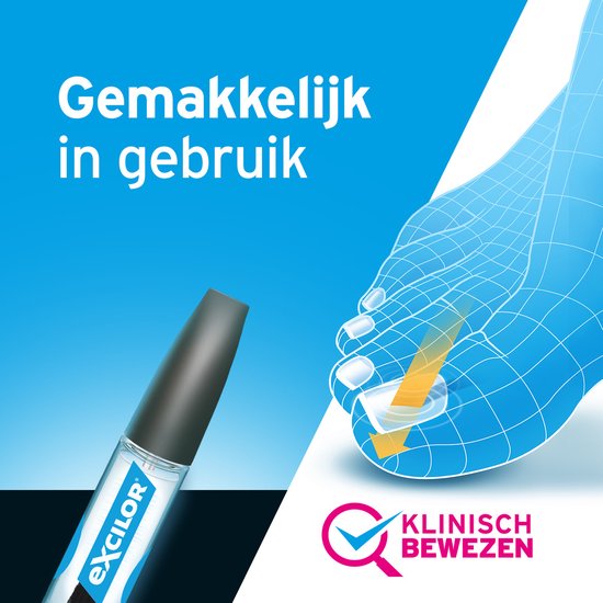 Excilor Kalknagel Behandeling - Effectieve bij schimmelnagels / kalknagels - Zichtbaar resultaat na 2 weken - Vijlen niet nodig - Klinisch bewezen - 3,3 ml