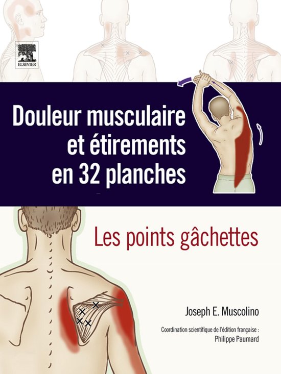 Douleur Musculaire Et �Tirements En 32 Planches
