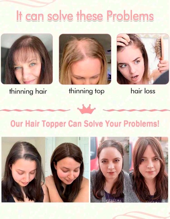 3 Stuks Pruik Handvat, Siliconen Zweetbestendige Hoofdband voor Hair Extensions (Wit, Donkerbruin, Lichtbruin