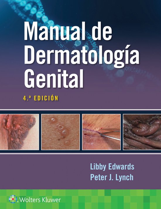 Manual de dermatología genital | 9788419284877 | Elizabeth Edwards ...