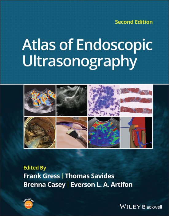 Atlas of Endoscopic Ultrasonography - cover