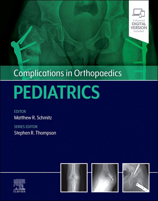 Medisch studieboek met röntgenfoto van een heup met schroeven, titel: Complications in Orthopaedics Pediatrics.