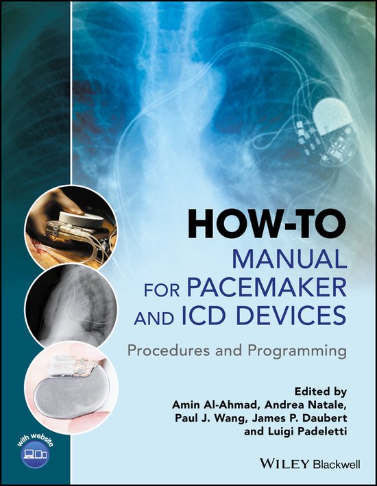 How–to Manual for Pacemaker and ICD Devices