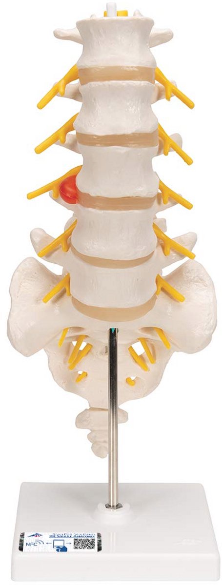 Menselijke anatomie model lumbale wervelkolom met tussenwervelschijf en gratis anatomiesoftware