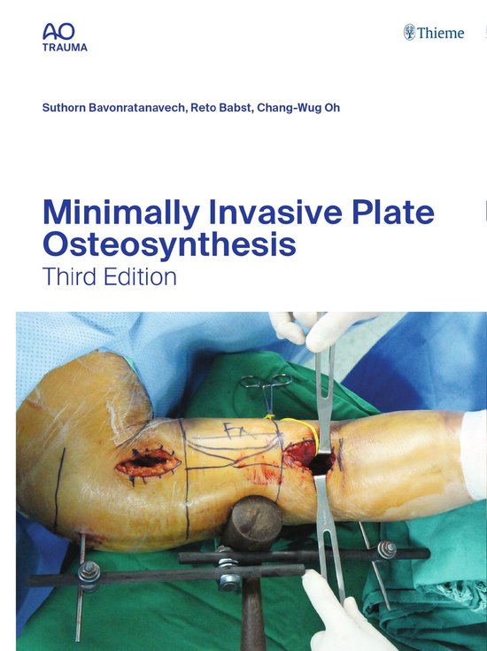 AO-Publishing - Minimally Invasive Plate Osteosynthesis - cover