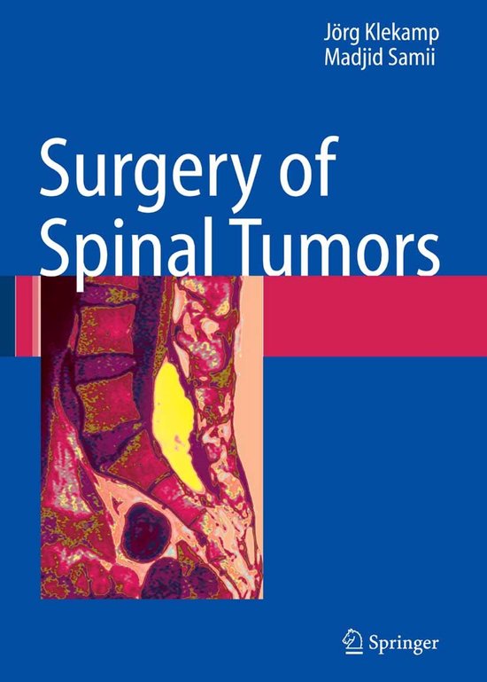 Surgery of Spinal Tumors - cover