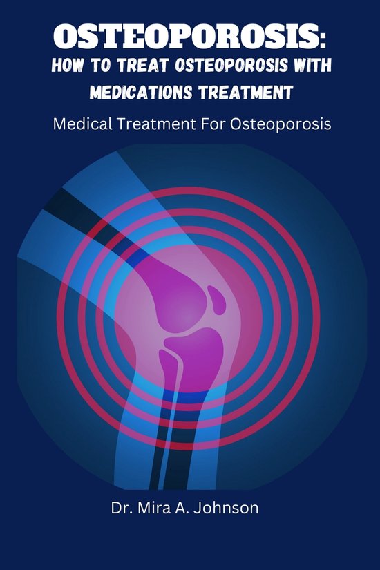 OsteoporosisHow to Treat Osteoporosis with medications Treatment
