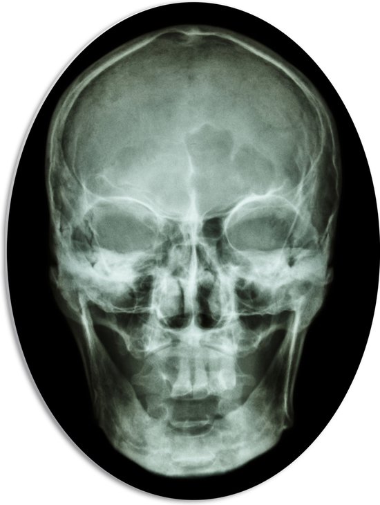 PVC Schuimplaat Ovaal - Röntgenfoto van Mensenschedel - 51x68 cm Foto op Ovaal (Met Ophangsysteem)