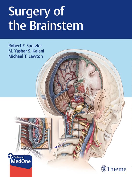 Surgery of the Brainstem - cover