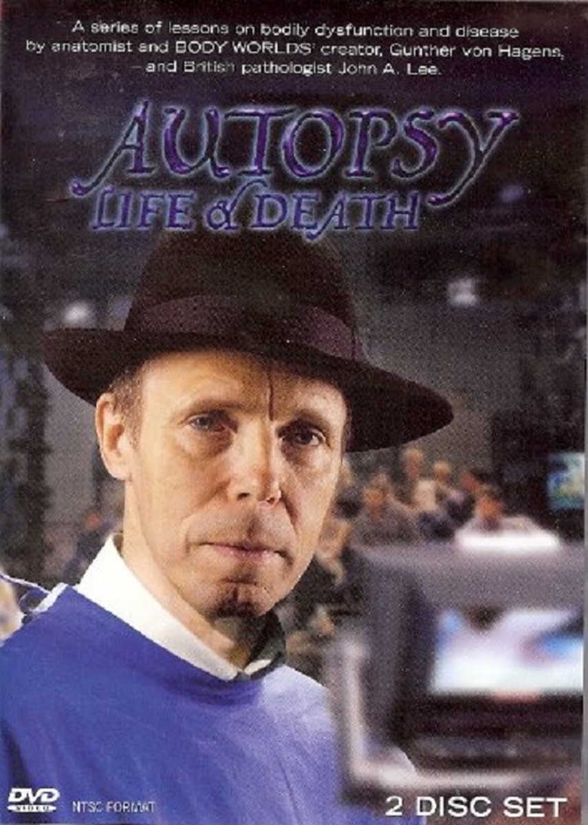 Autopsy Life & Death (PAL-Format)