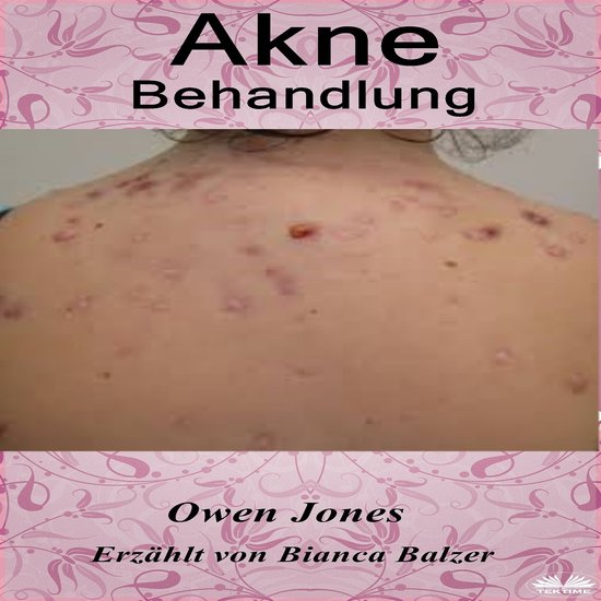 Akne-Behandlung - cover