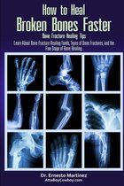 Health and Wellness- How to Heal Broken Bones Faster. Bone Fracture Healing Tips