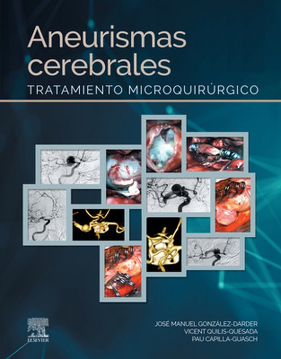 Aneurismas cerebrales - cover