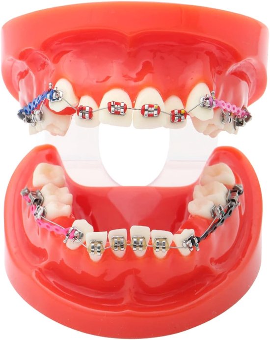 Set van 40 Elastische Rubber Tandbanden voor Orthodontie, Transparante Orthopedische Ringen en Ties, Ideaal voor Tandcorrectie en Beugels — afbeelding 3
