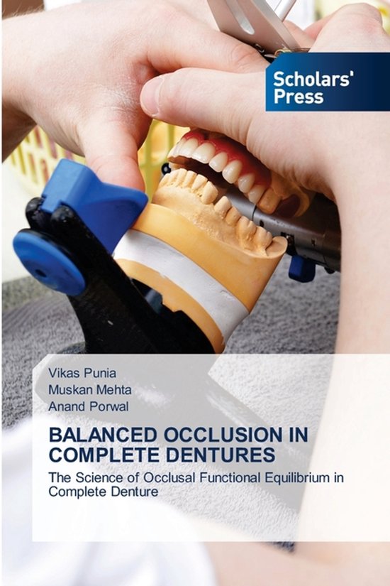 Boekomslag van 'Balanced Occlusion in Complete Dentures' met een gebitsmodel en de tekst 'Scholars' Press'.
