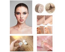 2 Stuks Zeer Effectieve Iraanse Rusur / Rushur Steen Scrub – 100% Natuurlijk – Hammam Peeling Gezicht & Lichaam Verwijderd Dode Huidcellen