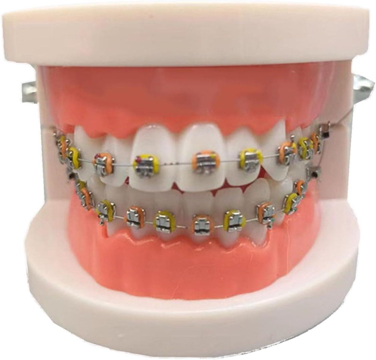 Tand Model - Educatief Hulpmiddel - Behandeling Uitleggen - Met Metalen Beugel - 1.8cm - Wit