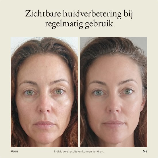 Voor- en nafoto's van een vrouwengezicht, met zichtbare huidverbetering na regelmatig gebruik.