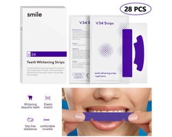 Smilekit Tandenbleek Strips Zonder Peroxide – tanden bleken – Witte Tanden – Veilige Tandenbleekset voor Thuis