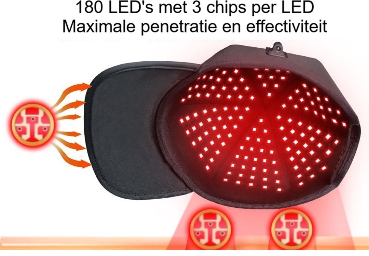 WK Roodlicht Haargroei Helm – 180 LED’s met 3 Chips per LED – 5 Intensiteitsniveaus – 24W Vermogen – Roodlicht Therapie tegen Haaruitval en Teruggang van de Haarlijn – Instelbaar & Comfortabel