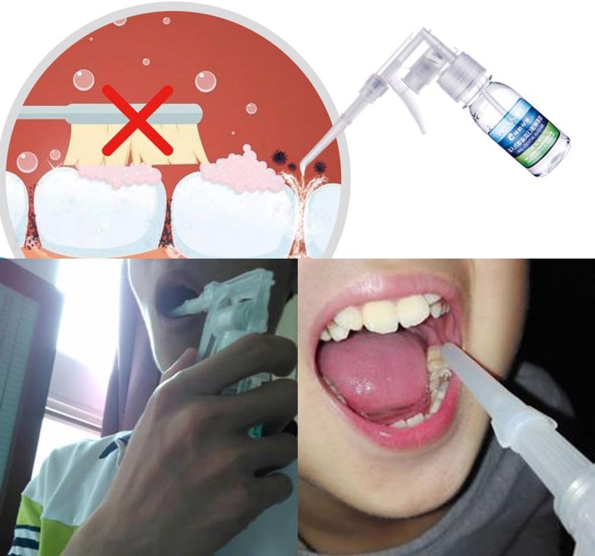 Orale Wasmachine Flosser - Water Irrigator Tanden - Verse Adem Spoelen - Draagbare Oor Wax Cleaner