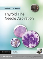 Thyroid Fine Needle Aspiration