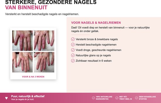 Twee afbeeldingen van handen: 'voor Dadi'Oil' met beschadigde nagels en 'na 3 weken' met herstelde nagels.