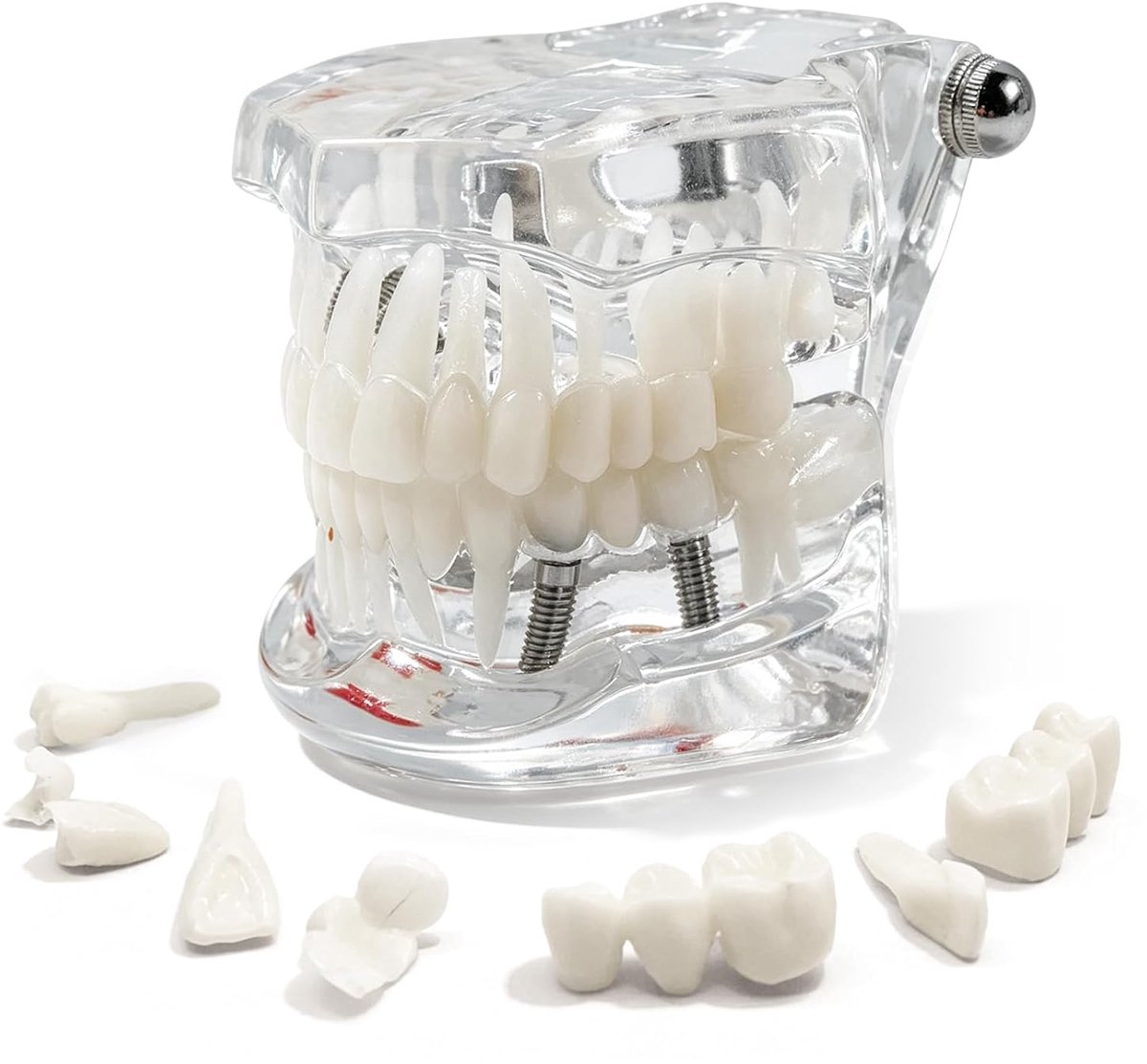 Transparant tandmodel - zacht plastic - met tandimplantaat - ideaal voor demonstraties - ShopVlot