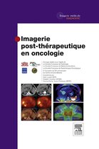 Imagerie post-th rapeutique en oncologie