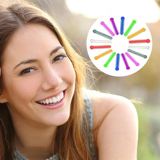 Set van 40 Elastische Rubber Tandbanden voor Orthodontie, Transparante Orthopedische Ringen en Ties, Ideaal voor Tandcorrectie en Beugels — afbeelding 4