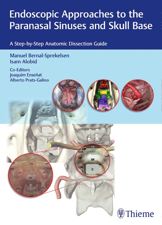 Endoscopic Approaches to the Paranasal Sinuses and Skull Bas ... - cover
