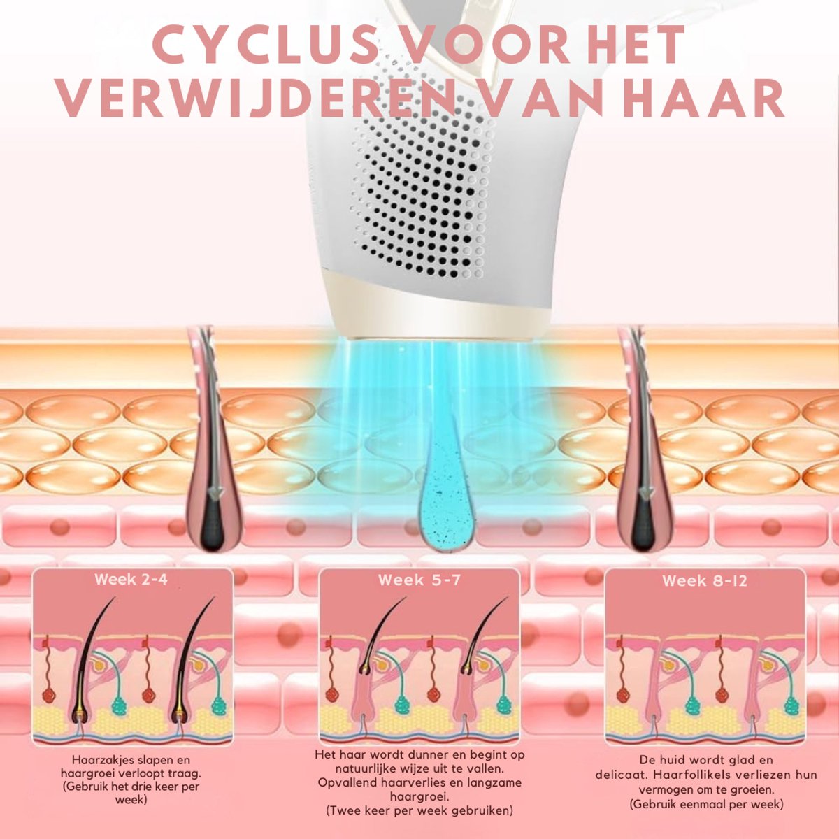 SVN® Laser Ontharingsapparaat – Haarverwijderaar IPL Technologie – Ontharingsapparaat Met 9 Energieniveaus - Wit- 24cmx 20cm x 6cm; 725 g thumbnail 4