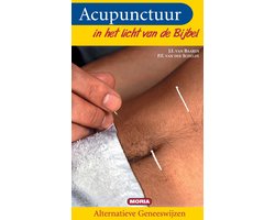 Acupunctuur