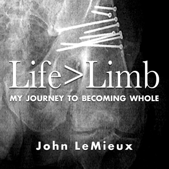 Life is Greater Than Limb - cover
