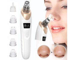 Hoge Kwaliteit Mee-Eter Verwijderen Vacuüm Gezichtsporie Reiniger Elektrische Anti Acne Bestrijden Tool 5 Sondes Voor Vrouwen En Mannen Gezicht Schoonheid