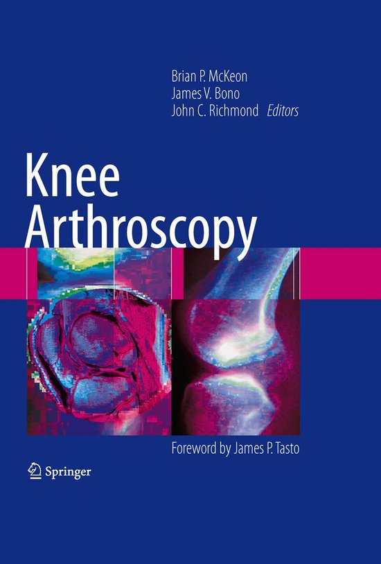 Knee Arthroscopy - cover