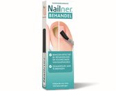 Nailner Kalknagelkwastje 5 ml - Kalknagelbehandeling voor Kalknagel en Schimmelnagel, Medische hulpmiddelen om Kalknagels te behandelen en voorkomen, effectief binnen 4 weken, eenvoudig aan te brengen zonder te vijlen, voor dagelijks gebruik