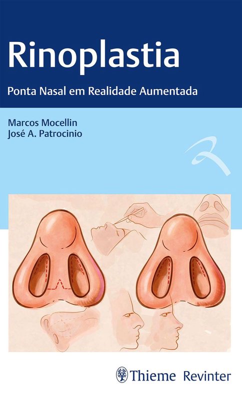 Rinoplastia - cover