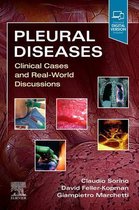 Pleural Diseases,E-Book