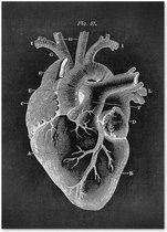 Anatomy Poster Heart Black - 21x30cm Canvas - Multi-color