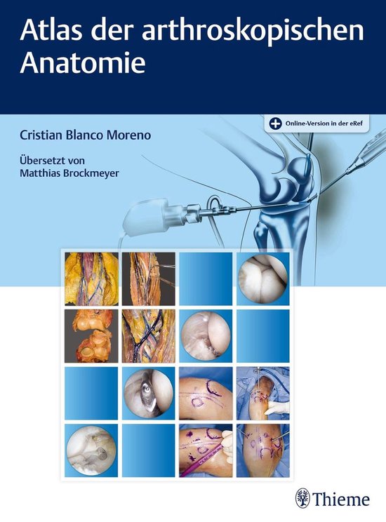 Atlas der arthroskopischen Anatomie - cover