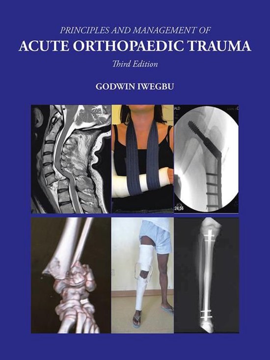Principles and Management of Acute Orthopaedic Trauma - cover