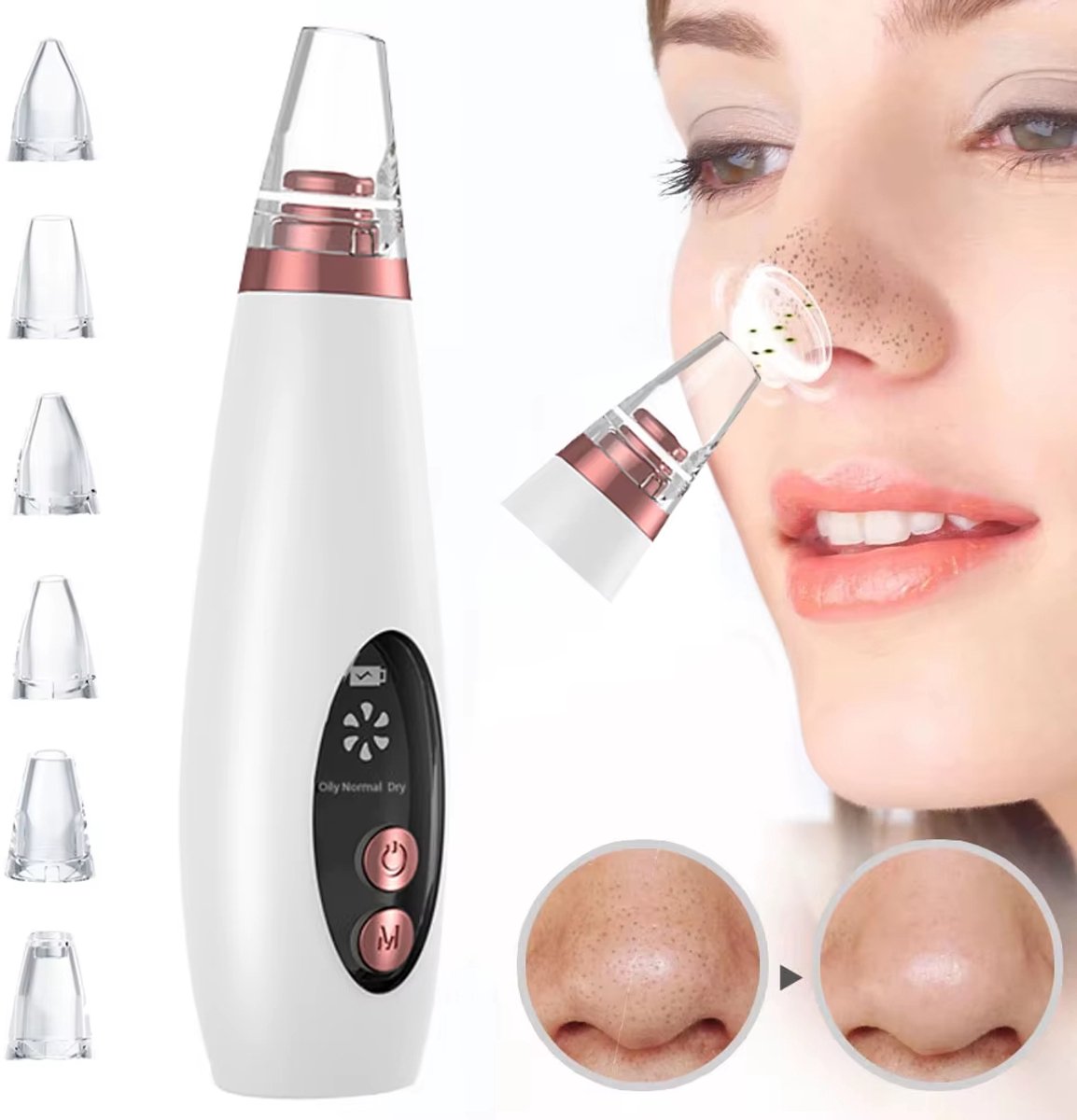 Elektrische Mee-eter Verwijderaar en Poriënreiniger – Diepe Gezichtsreiniging voor Acne, Zwarte Puntjes, Talg en Huidverzorging – Pore Cleaner, Acne Verwijderaar, Blackhead Remover