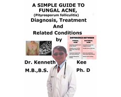 A Simple Guide to Fungal Acne, (Pityrosporum folliculitis) Diagnosis, Treatment and Related Conditions