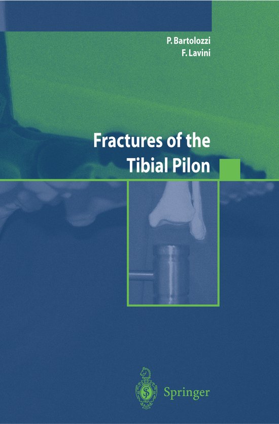 Fractures of the Tibial Pilon - cover