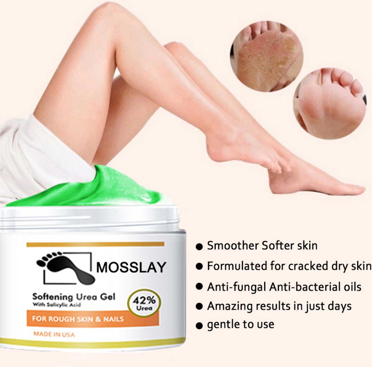 Mosslay 42% Urea Gel intensieve natuurlijke voeten creme - onmiddellijke verzachting van eelt - ruwe plekken - extreem droge voetenhuid – Assortiment ‘Het Gemak’